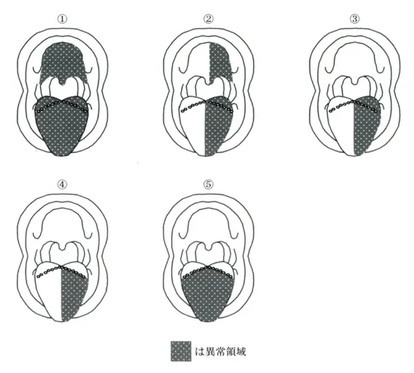 第100回 G問題 第37問の問題画像