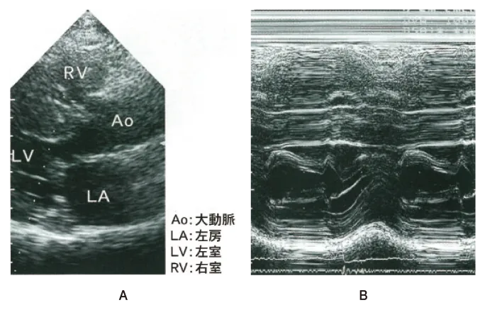 第102回 D問題 第26問の問題画像