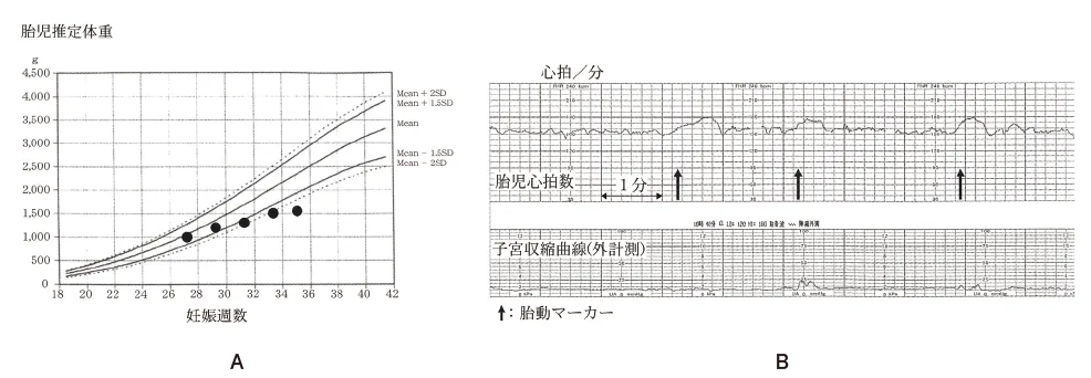 第102回 G問題 第62問の問題画像