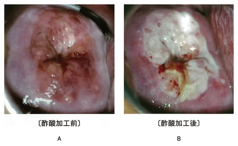 第102回 I問題 第41問の問題画像