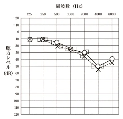 第103回 E問題 第54問の問題画像