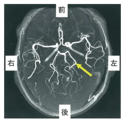 第105回 B問題 第6問の問題画像