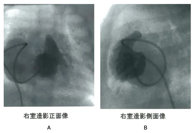 第105回 D問題 第39問の問題画像