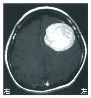 第105回 F問題 第24問の問題画像