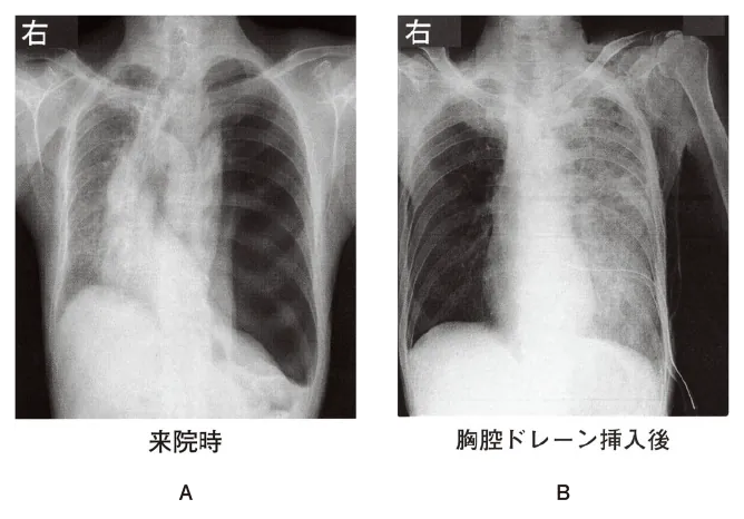 第106回 B問題 第44問の問題画像