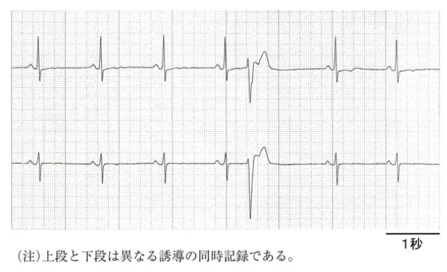 第106回 H問題 第24問の問題画像