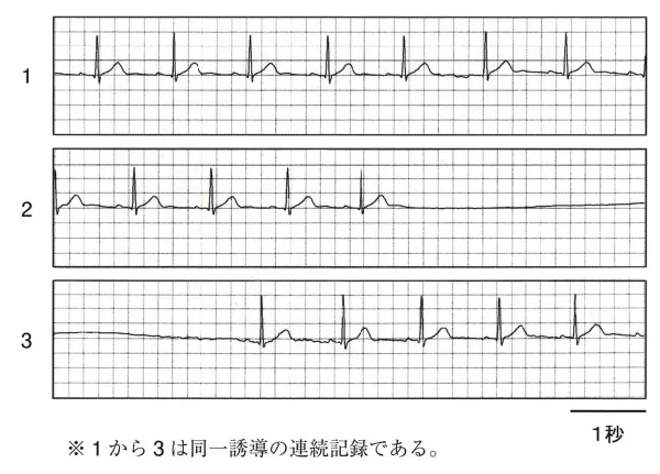 第106回 I問題 第50問の問題画像