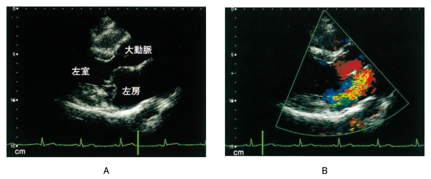 第107回 A問題 第31問の問題画像