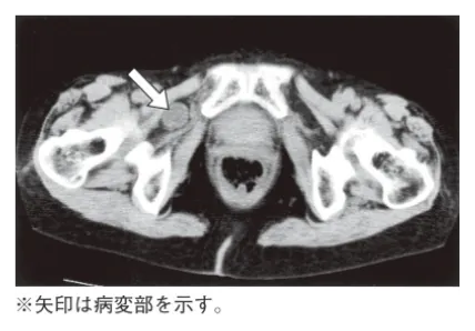 第107回 D問題 第36問の問題画像