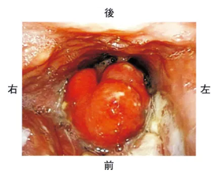 第107回 I問題 第50問の問題画像