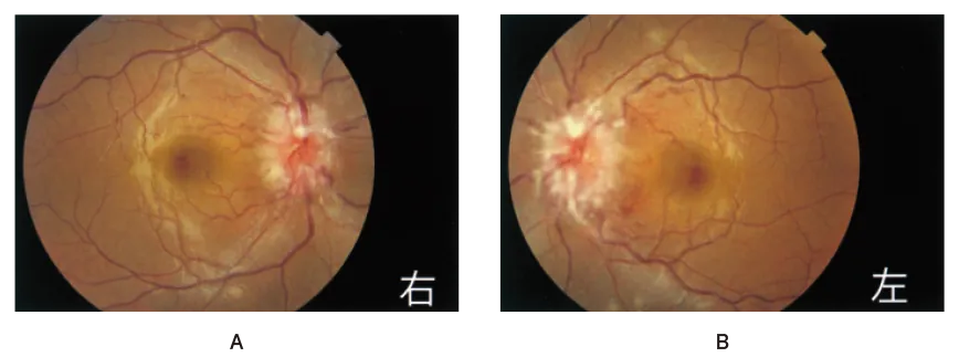 第108回 A問題 第23問の問題画像