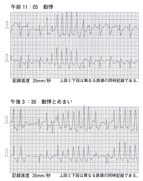 第109回 D問題 第33問の問題画像