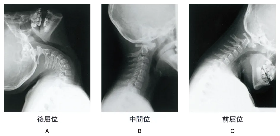 第109回 D問題 第43問の問題画像