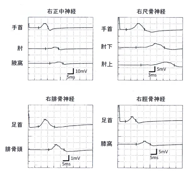 第109回 E問題 第50問の問題画像
