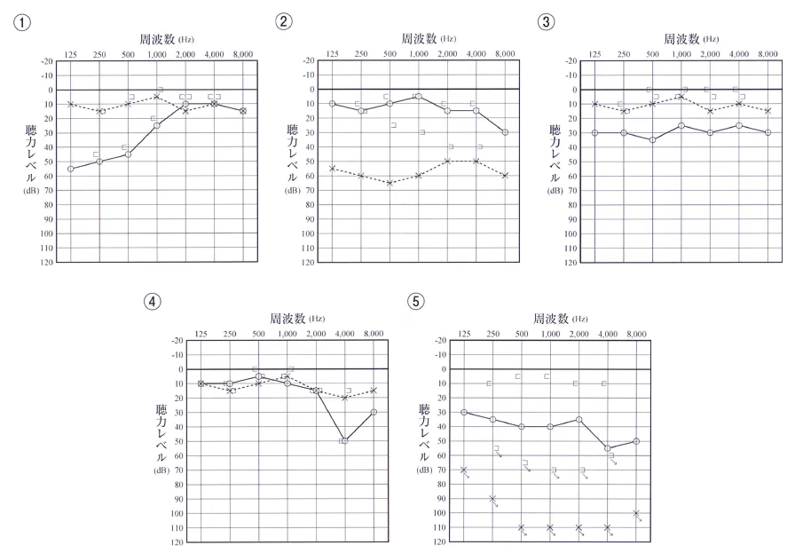 第109回 G問題 第52問の問題画像
