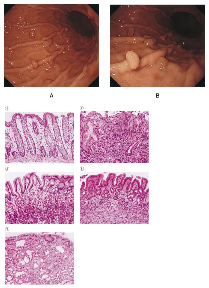 第109回 G問題 第68問の問題画像