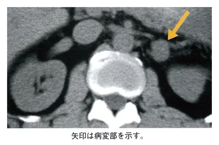 第109回 I問題 第78問の問題画像