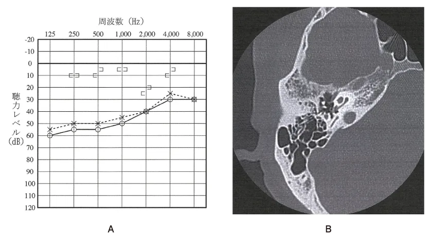第110回 A問題 第37問の問題画像
