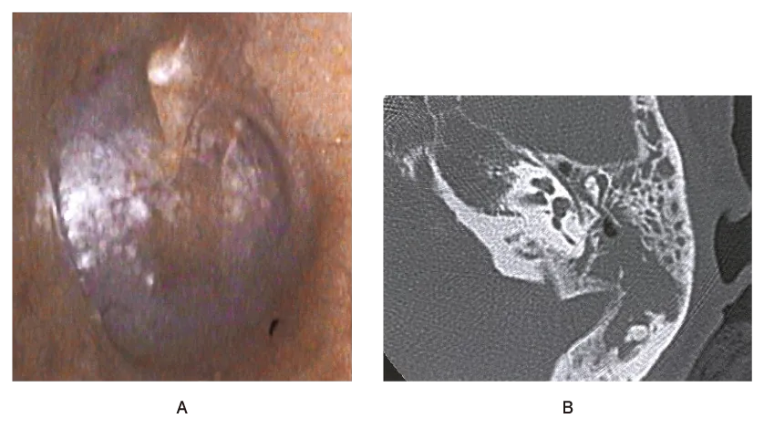 第110回 A問題 第45問の問題画像