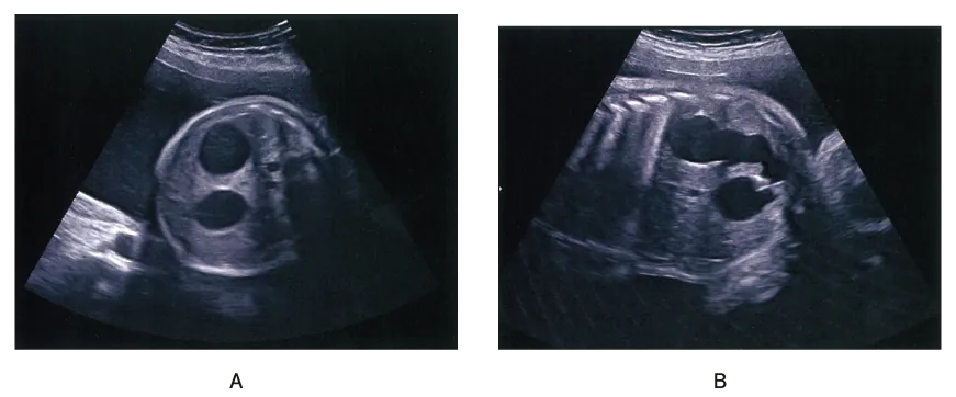 第110回 D問題 第50問の問題画像