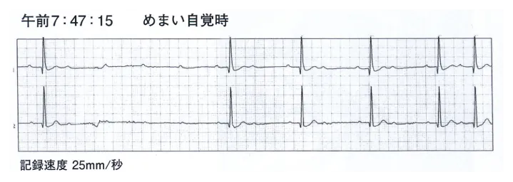 第110回 D問題 第54問の問題画像