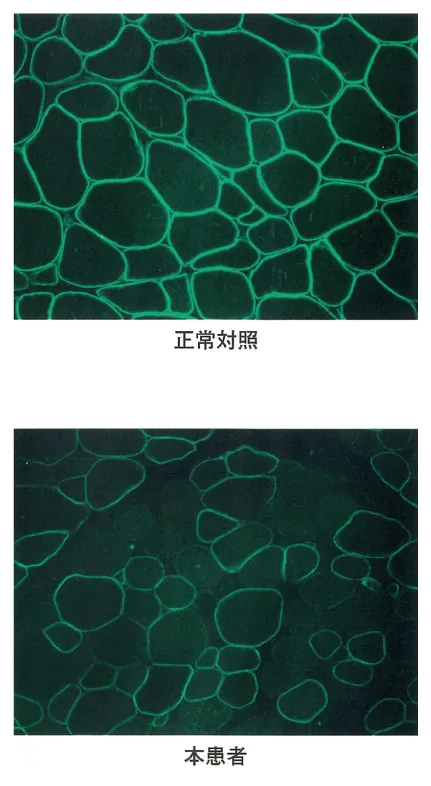 第110回 I問題 第74問の問題画像