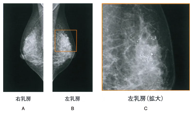 第111回 I問題 第49問の問題画像
