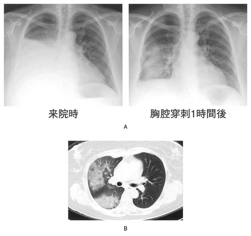 第112回 A問題 第41問の問題画像