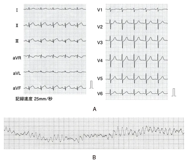 第112回 B問題 第45問の問題画像