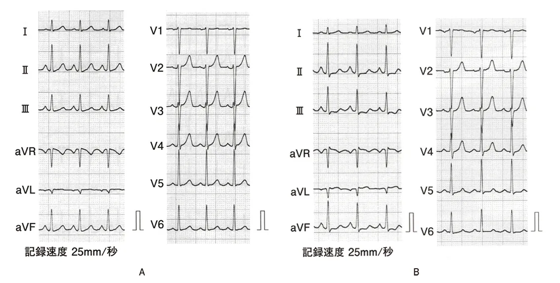第112回 D問題 第50問の問題画像