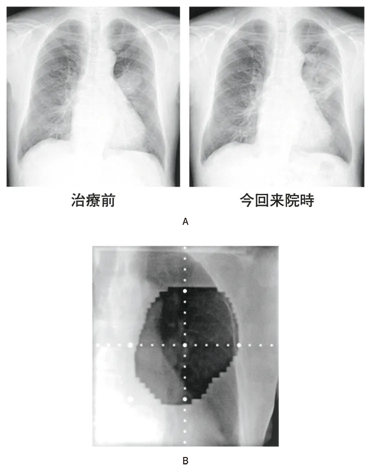 第112回 F問題 第47問の問題画像