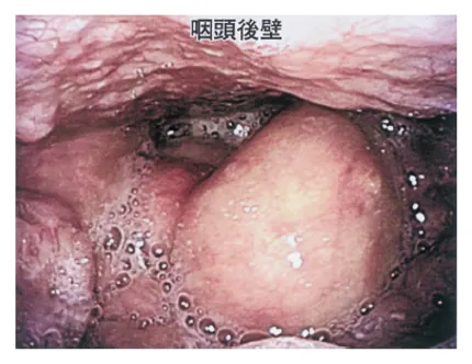 第113回 D問題 第41問の問題画像