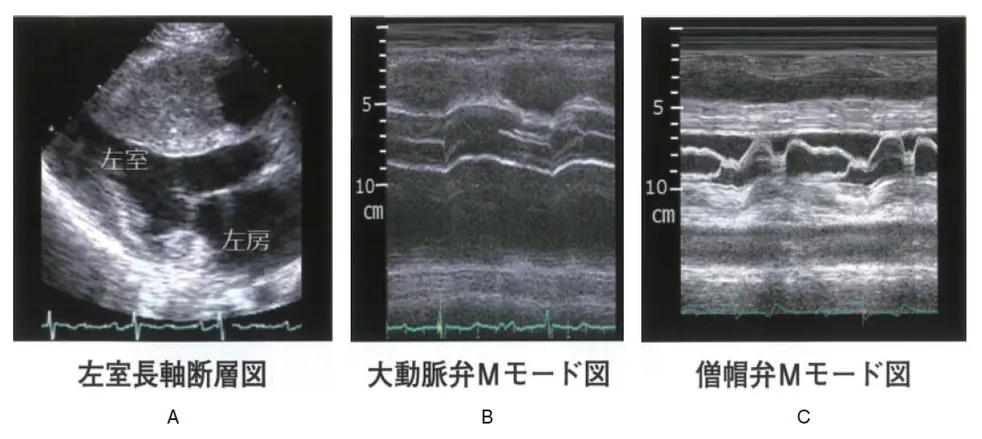 第114回 A問題 第14問の問題画像