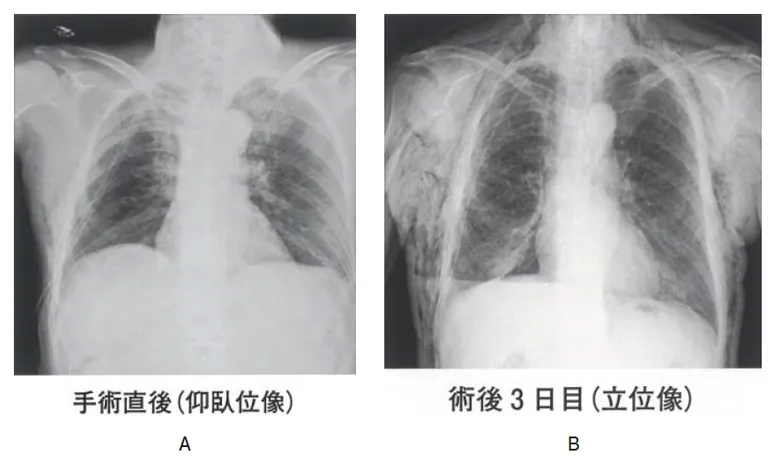 第114回 A問題 第38問の問題画像