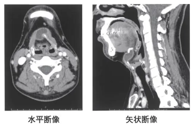 第114回 A問題 第43問の問題画像