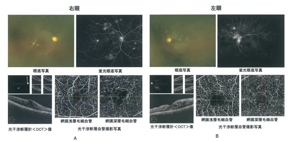 第114回 C問題 第54問の問題画像