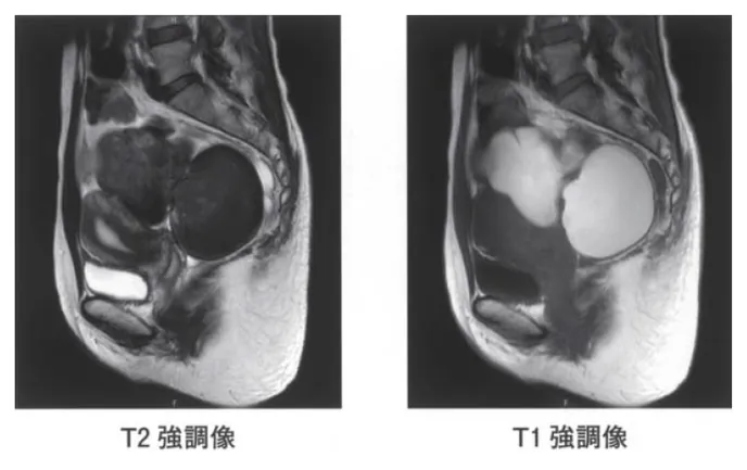 第114回 C問題 第58問の問題画像