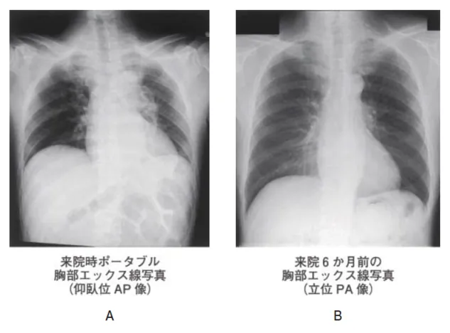 第114回 C問題 第71問の問題画像