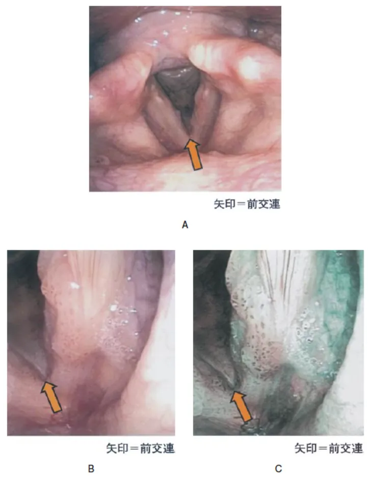 第114回 F問題 第50問の問題画像