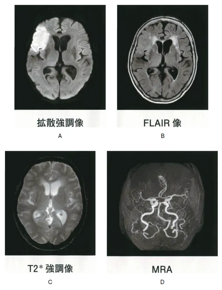 第115回 A問題 第58問の問題画像