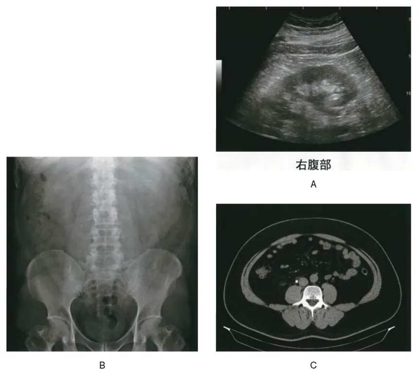 第115回 D問題 第73問の問題画像