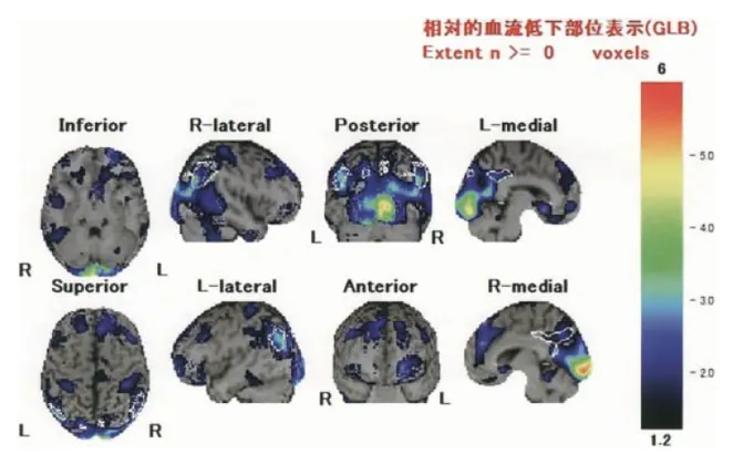 第115回 F問題 第69問の問題画像