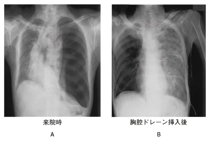 第116回 A問題 第20問の問題画像