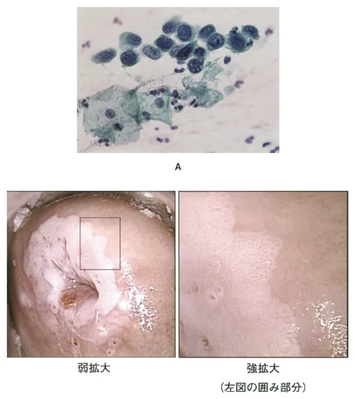 第116回 D問題 第61問の問題画像