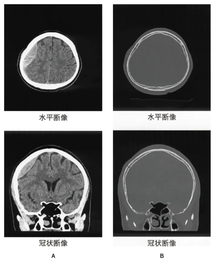 第116回 D問題 第71問の問題画像