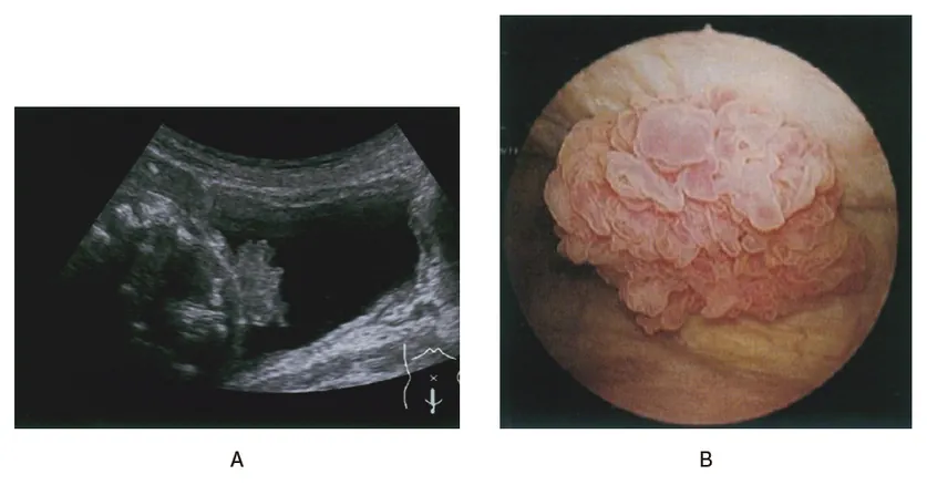 第116回 D問題 第72問の問題画像