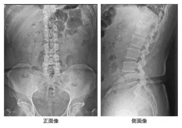 第116回 F問題 第35問の問題画像
