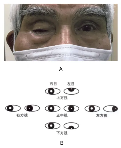 第117回 B問題 第39問の問題画像