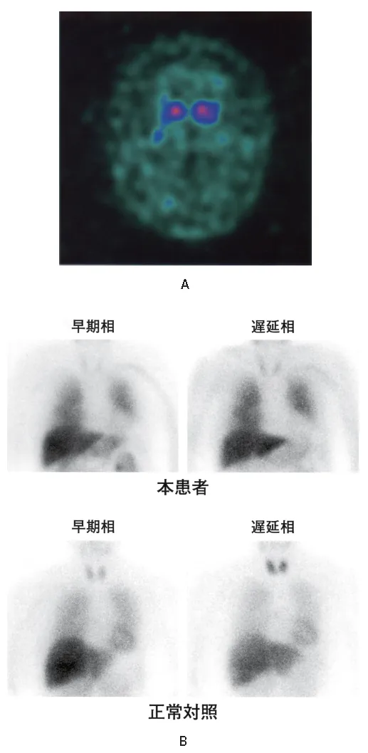 第117回 F問題 第68問の問題画像