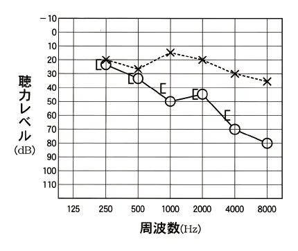 第99回 G問題 第11問の問題画像